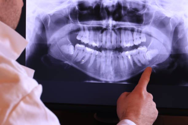 Best Emergency Dental Extractions in Fabens, TX